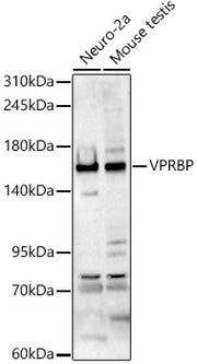 VPRBP Rabbit pAb