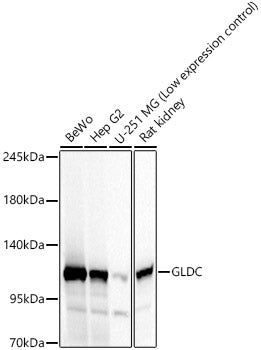 GLDC Rabbit pAb
