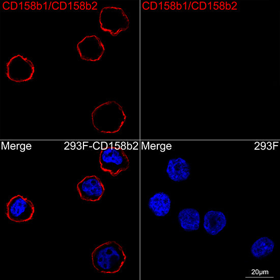 KIR2DL2/KIR2DL3 Rabbit mAb