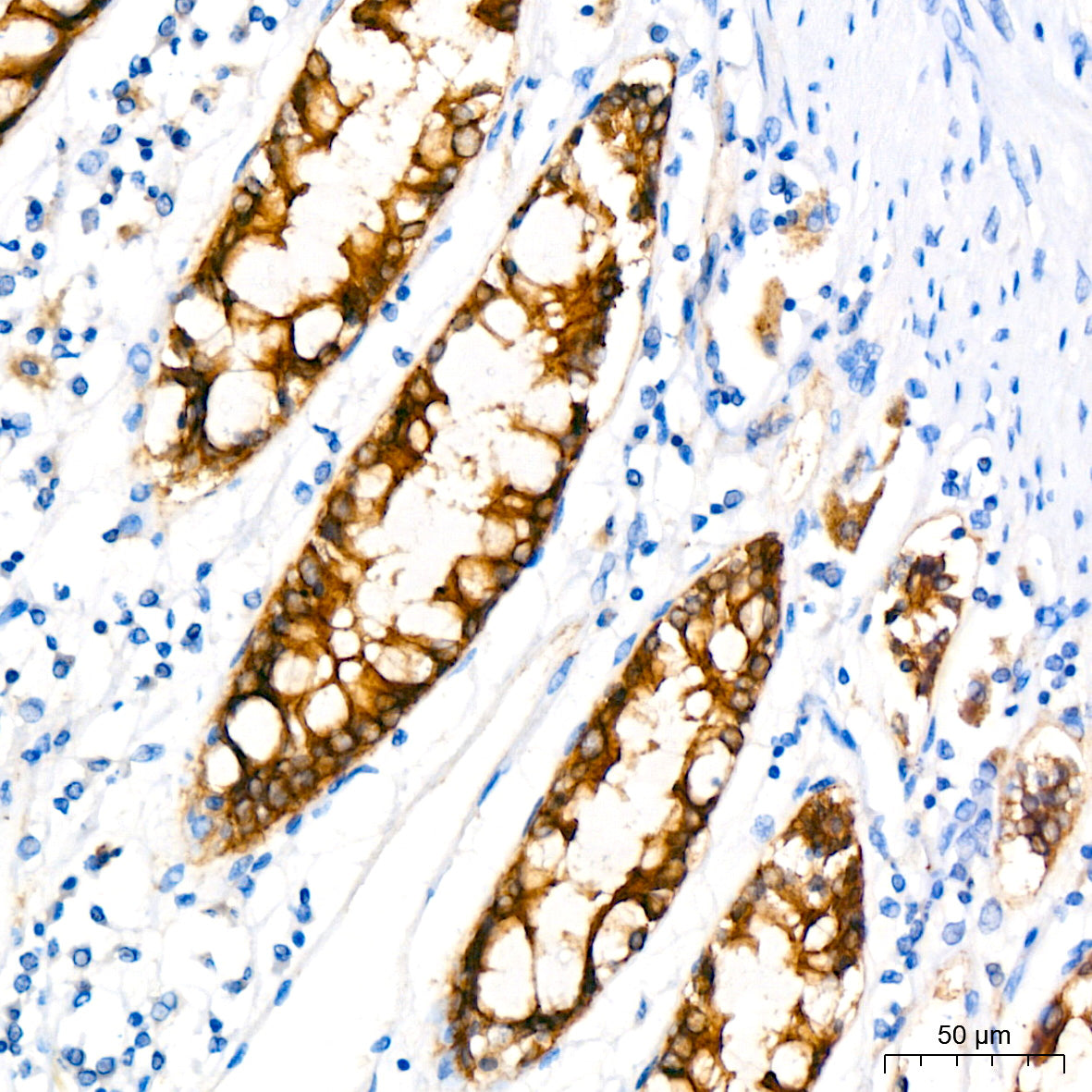 Occludin Rabbit mAb