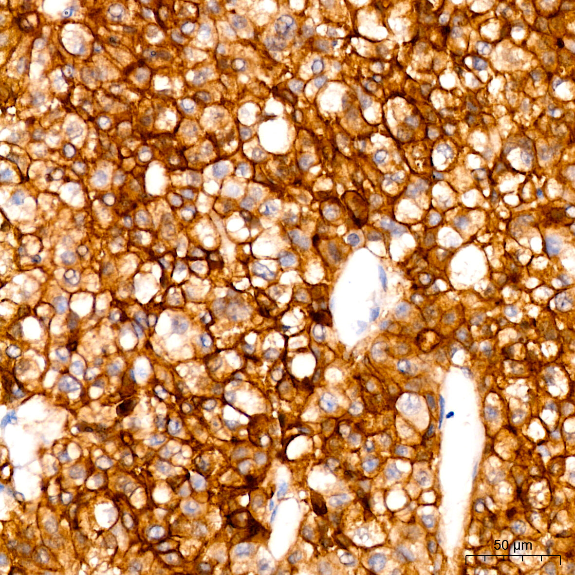 Occludin Rabbit mAb