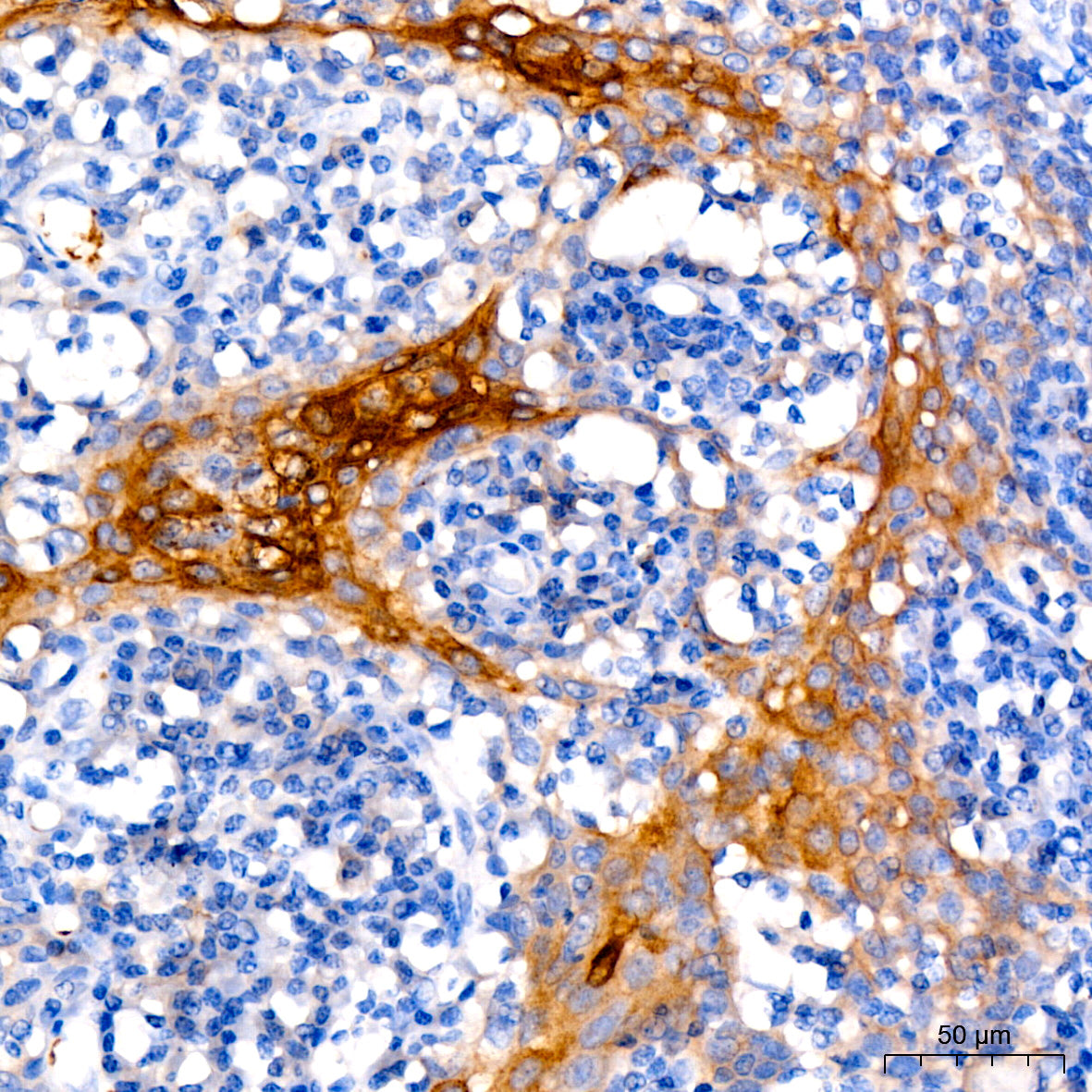 Occludin Rabbit mAb