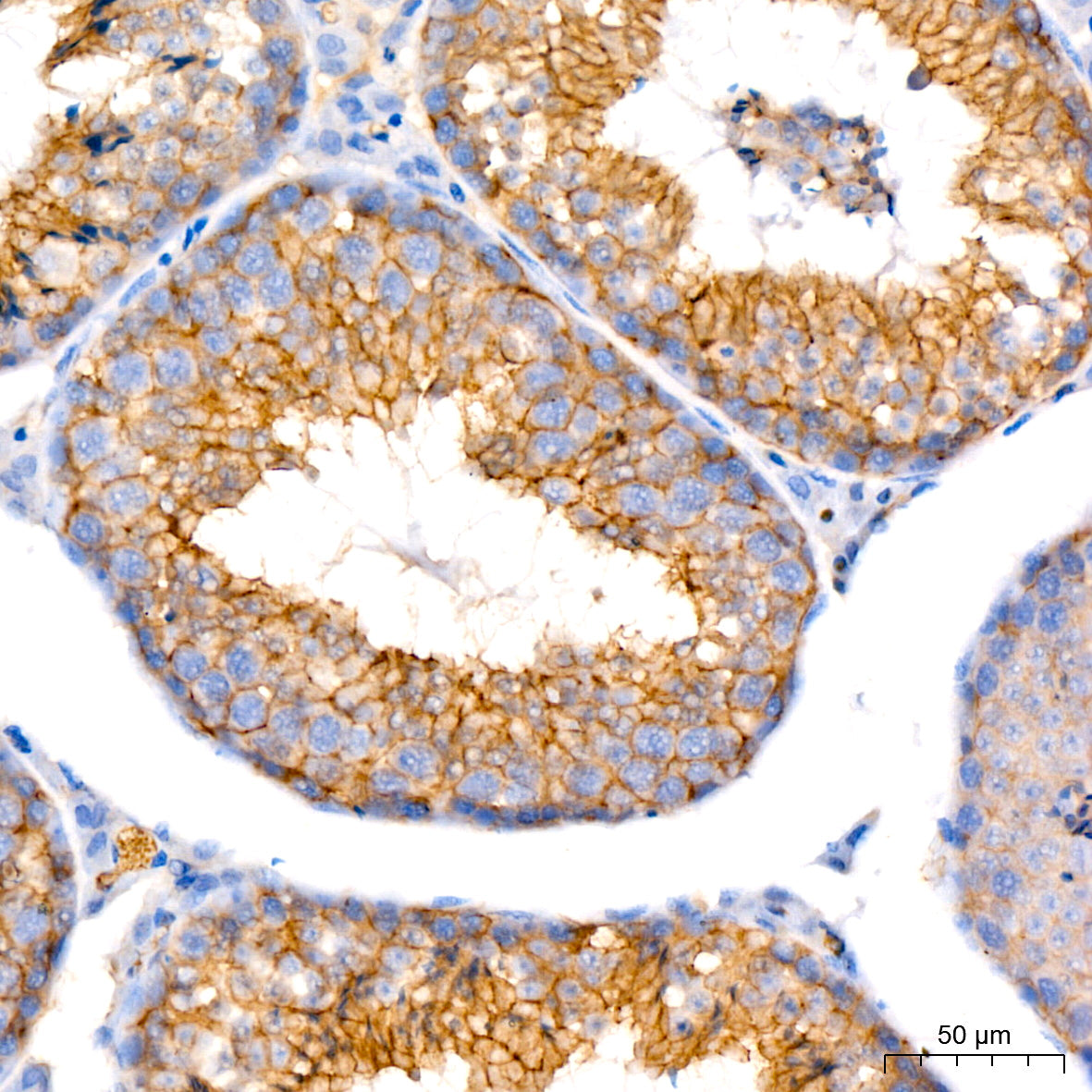 Occludin Rabbit mAb
