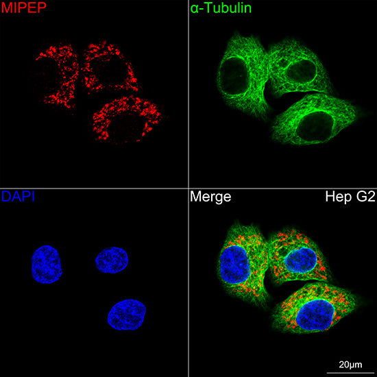 MIPEP Rabbit mAb