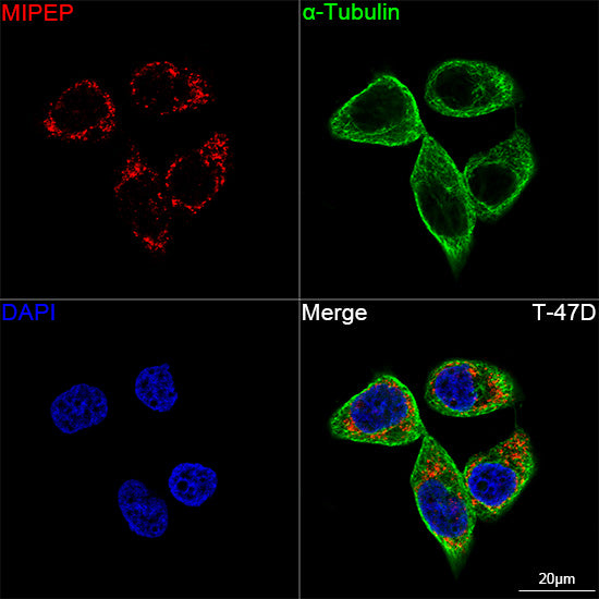 MIPEP Rabbit mAb