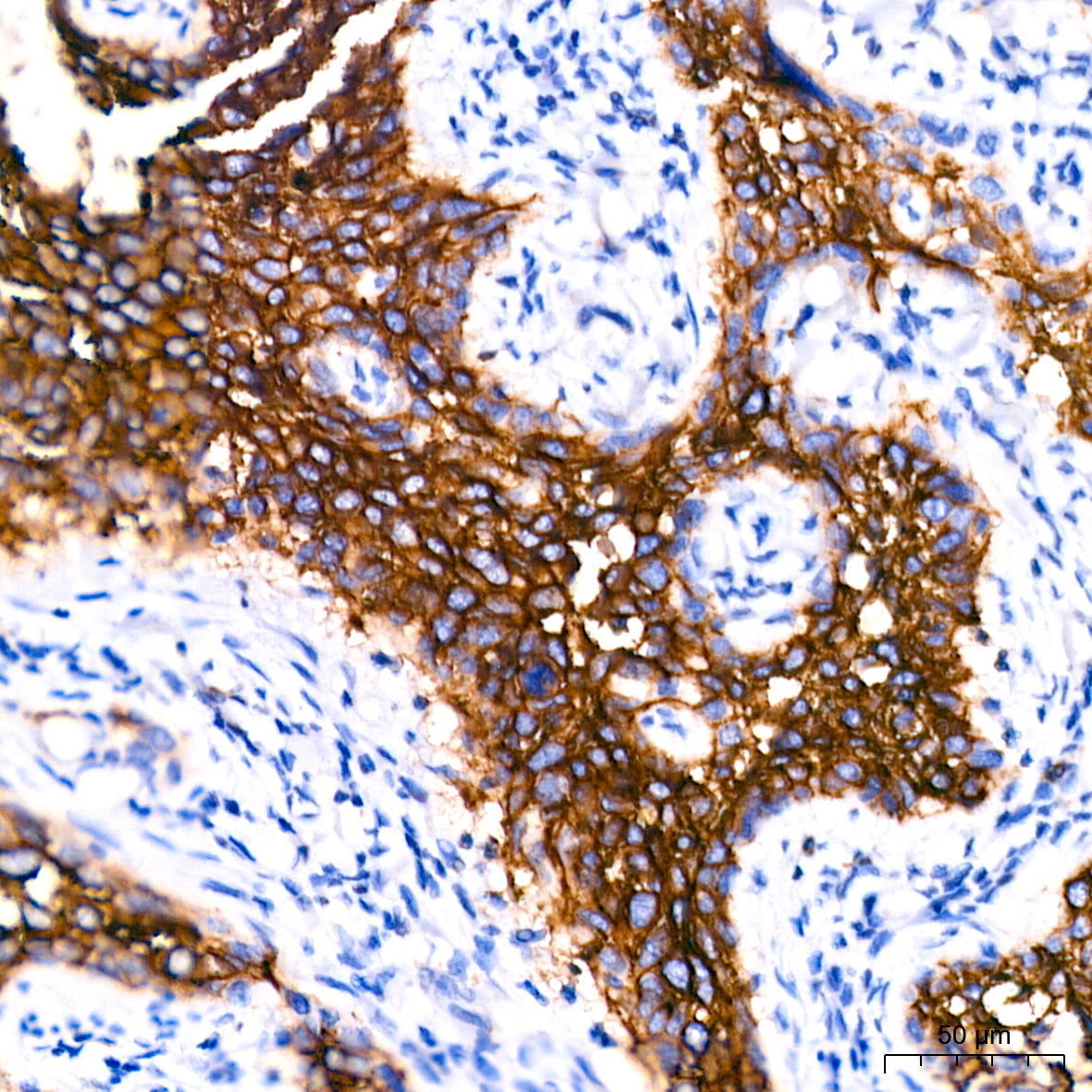 Claudin-3 Rabbit mAb
