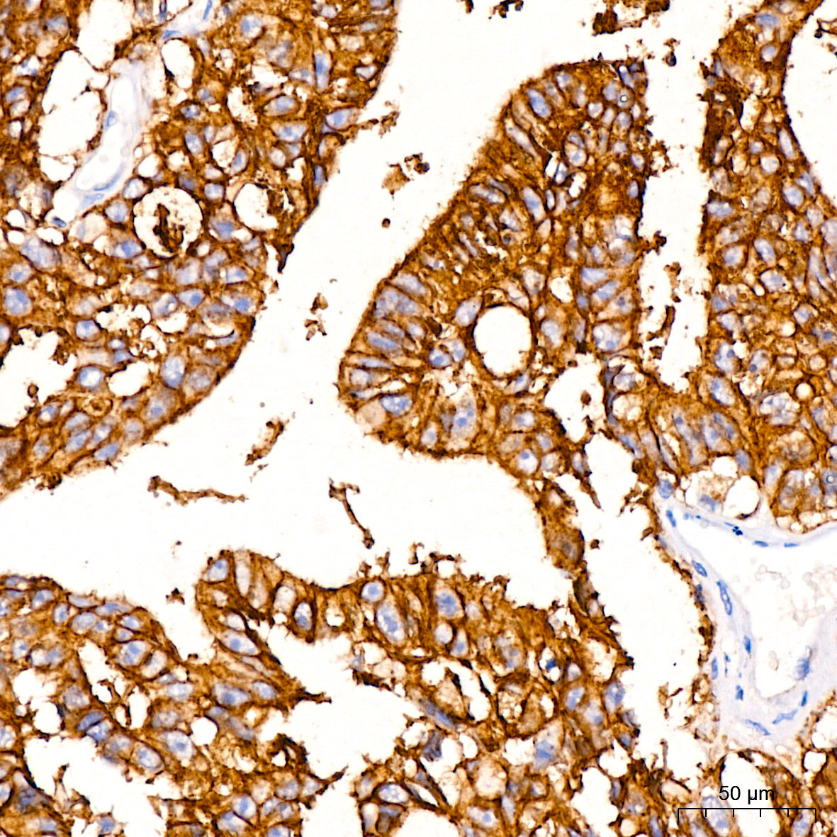 Claudin-3 Rabbit mAb