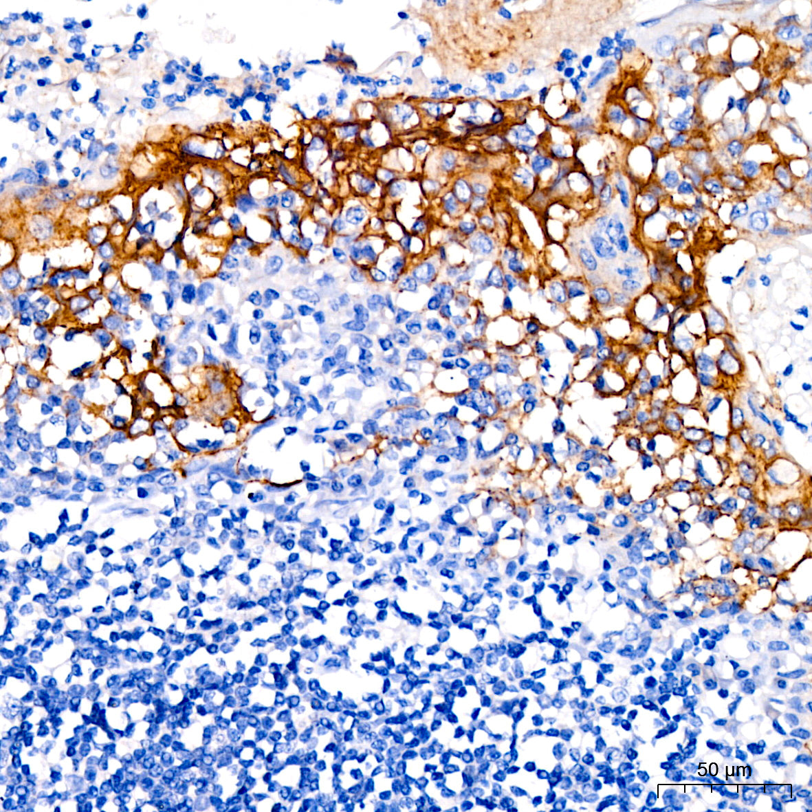 Claudin-3 Rabbit mAb