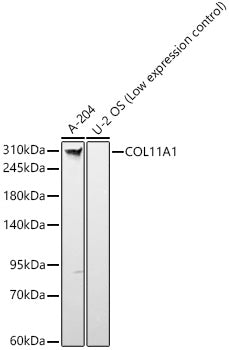 COL11A1 Rabbit mAb