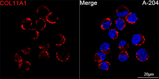 COL11A1 Rabbit mAb