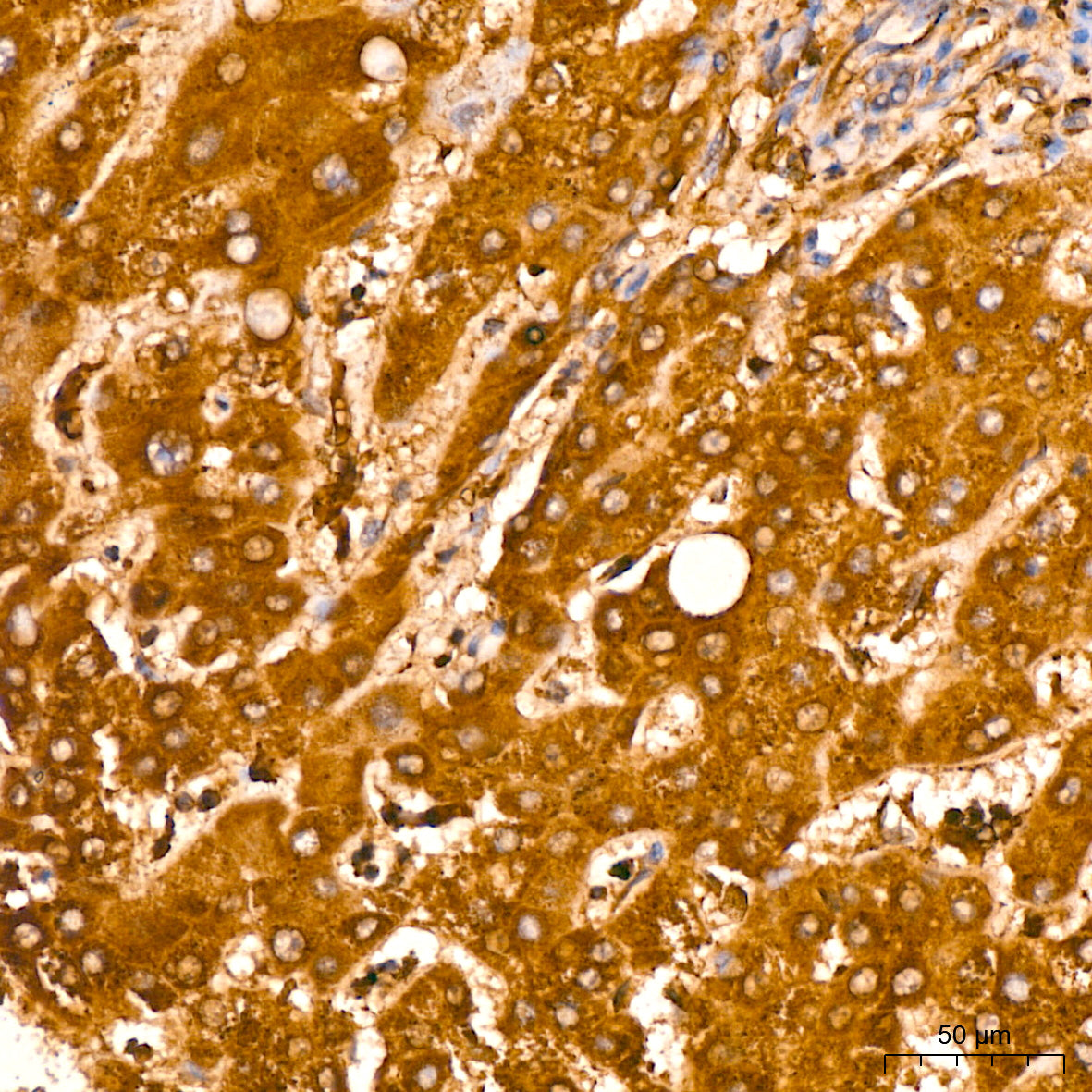 PMPCA Rabbit mAb