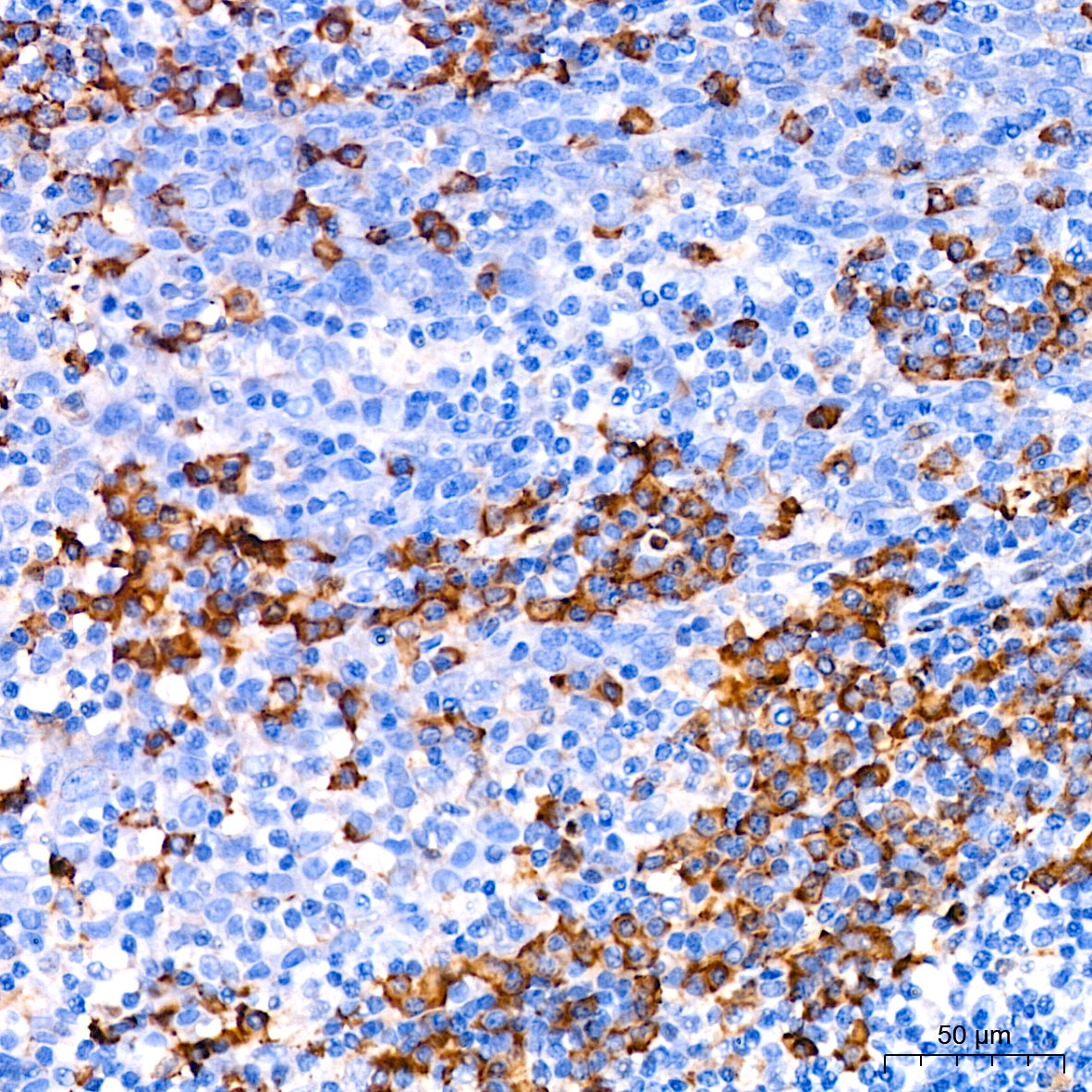 CDA Rabbit mAb