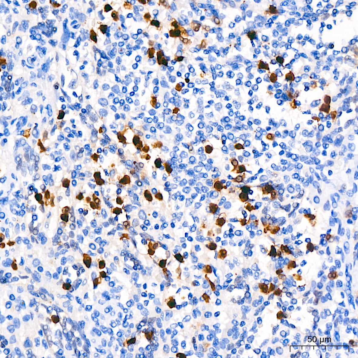 CDA Rabbit mAb