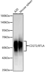 CD272/BTLA Rabbit mAb