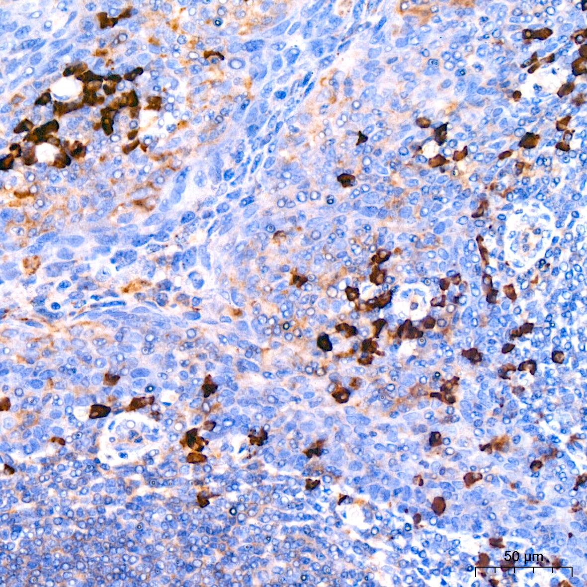 Human Lambda Light Chain Rabbit mAb