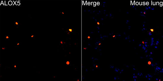 ALOX5 Rabbit mAb