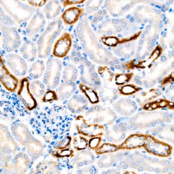 BCKDHB Rabbit mAb