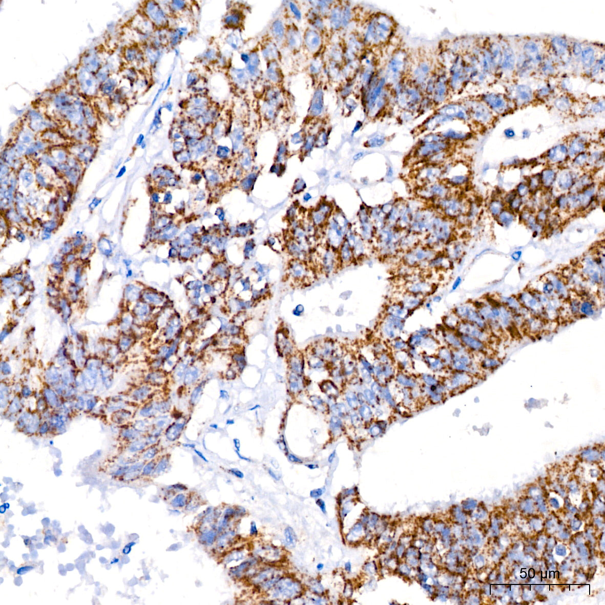ATPIF1 Rabbit mAb