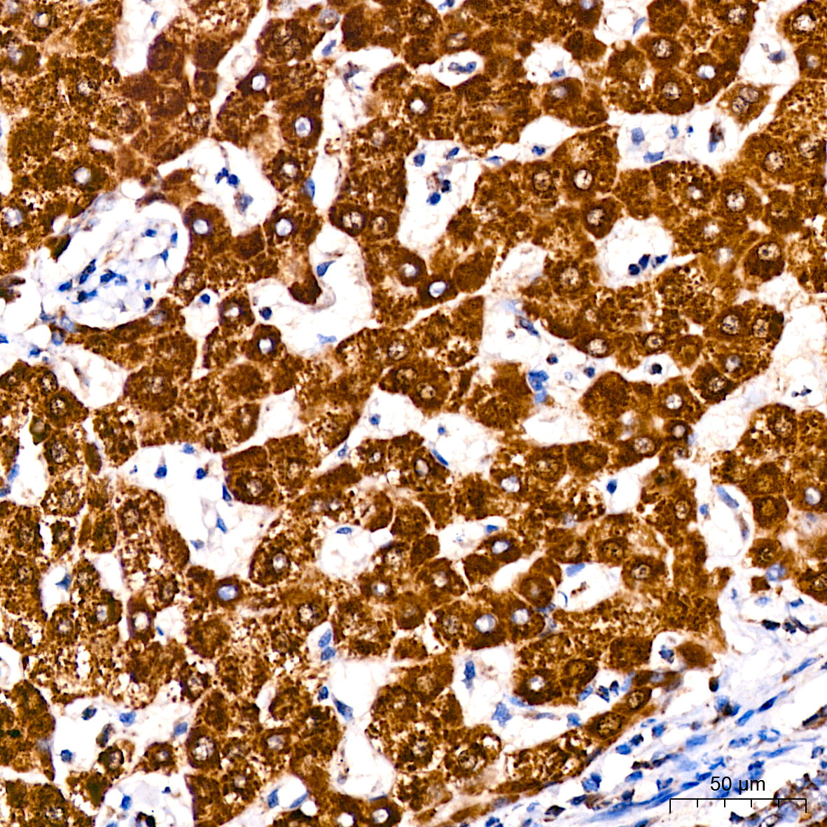 ATPIF1 Rabbit mAb
