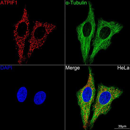 ATPIF1 Rabbit mAb