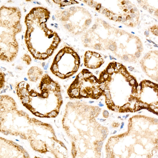 Uromodulin/UMOD Rabbit mAb