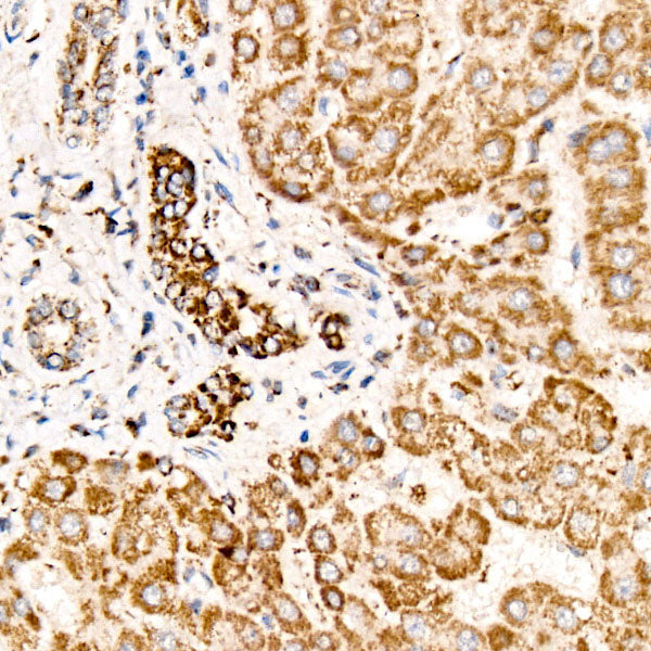 Uromodulin/UMOD Rabbit mAb
