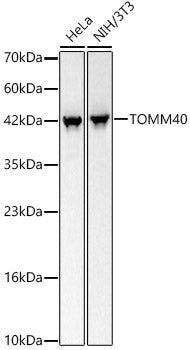 TOMM40 Rabbit mAb