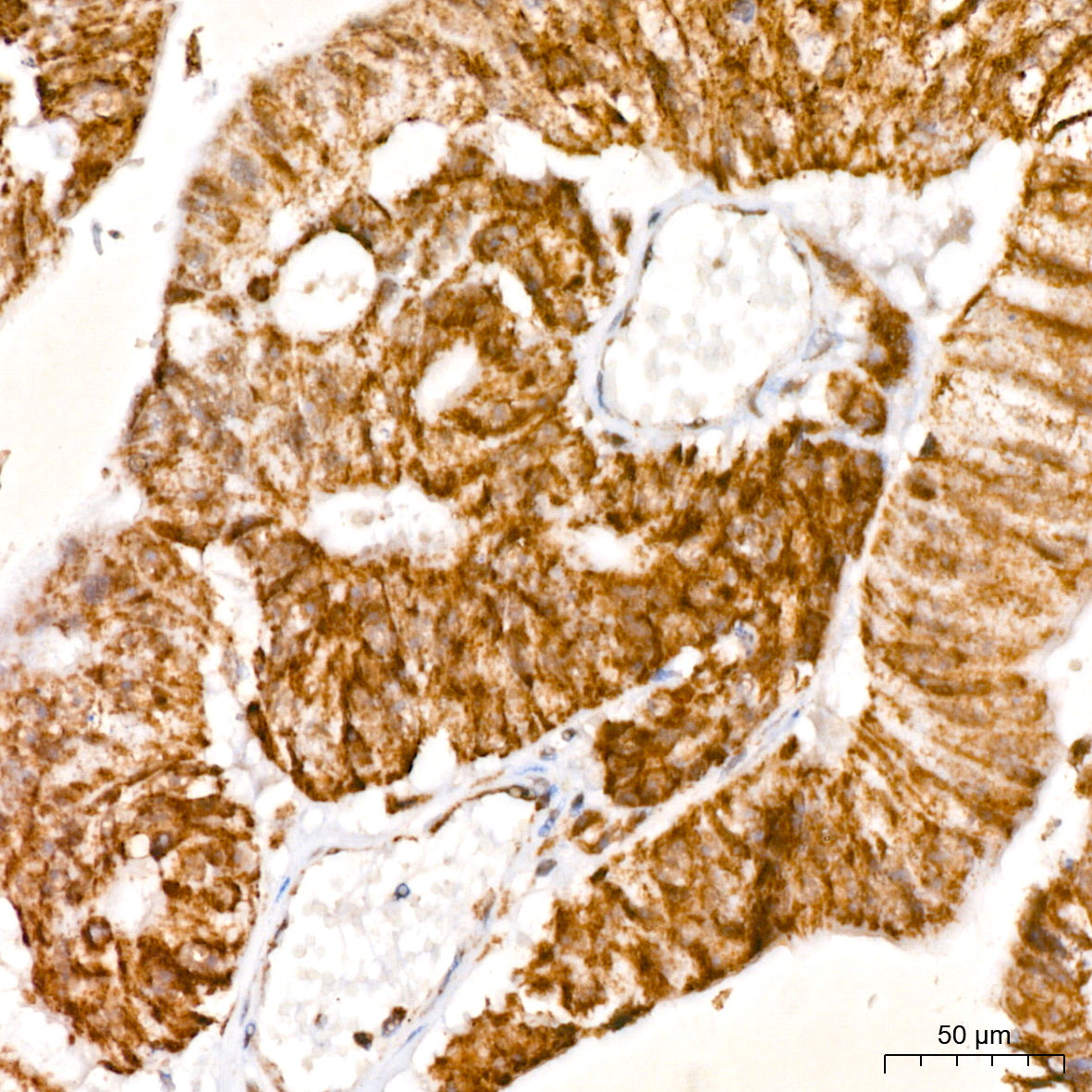 TOMM40 Rabbit mAb