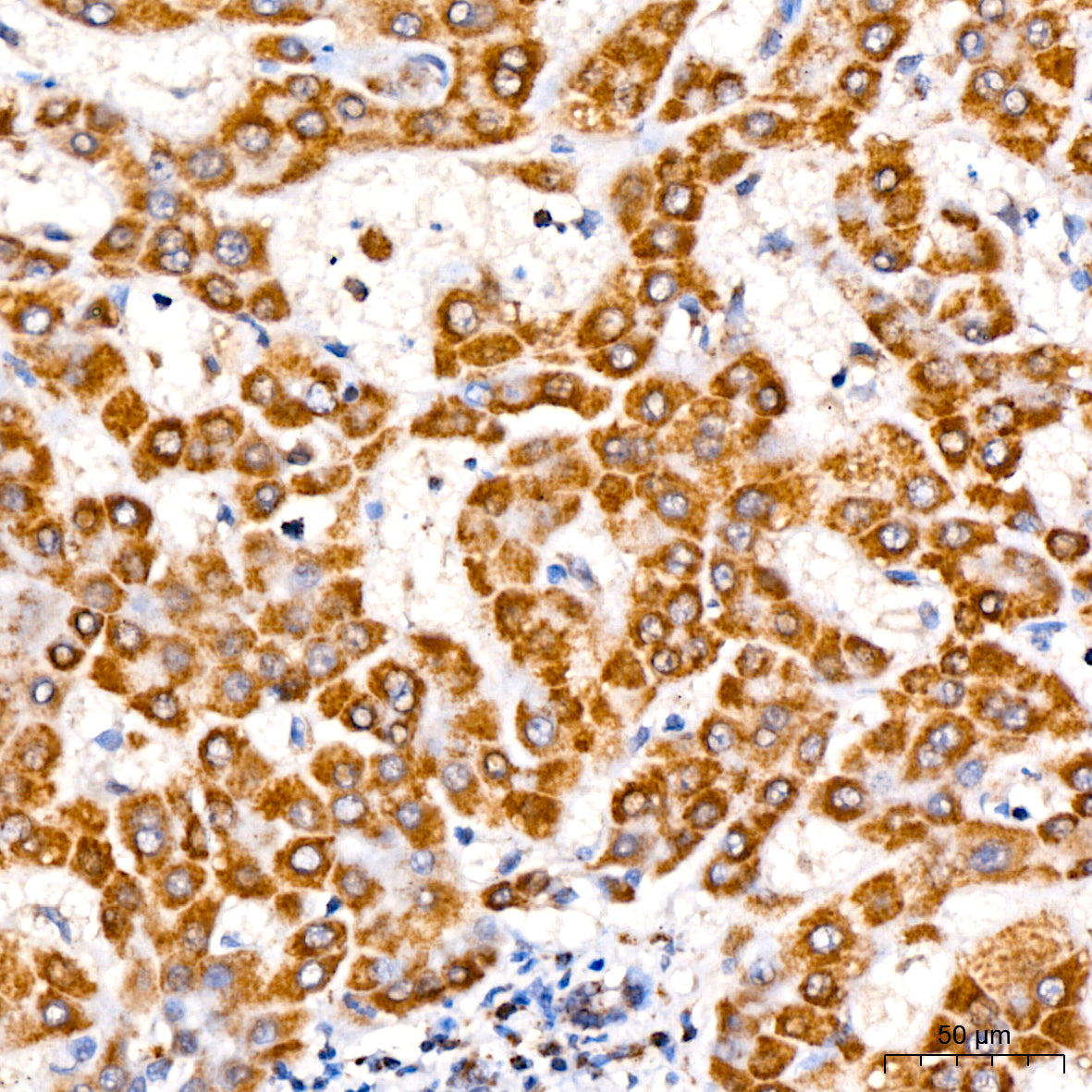 TOMM40 Rabbit mAb