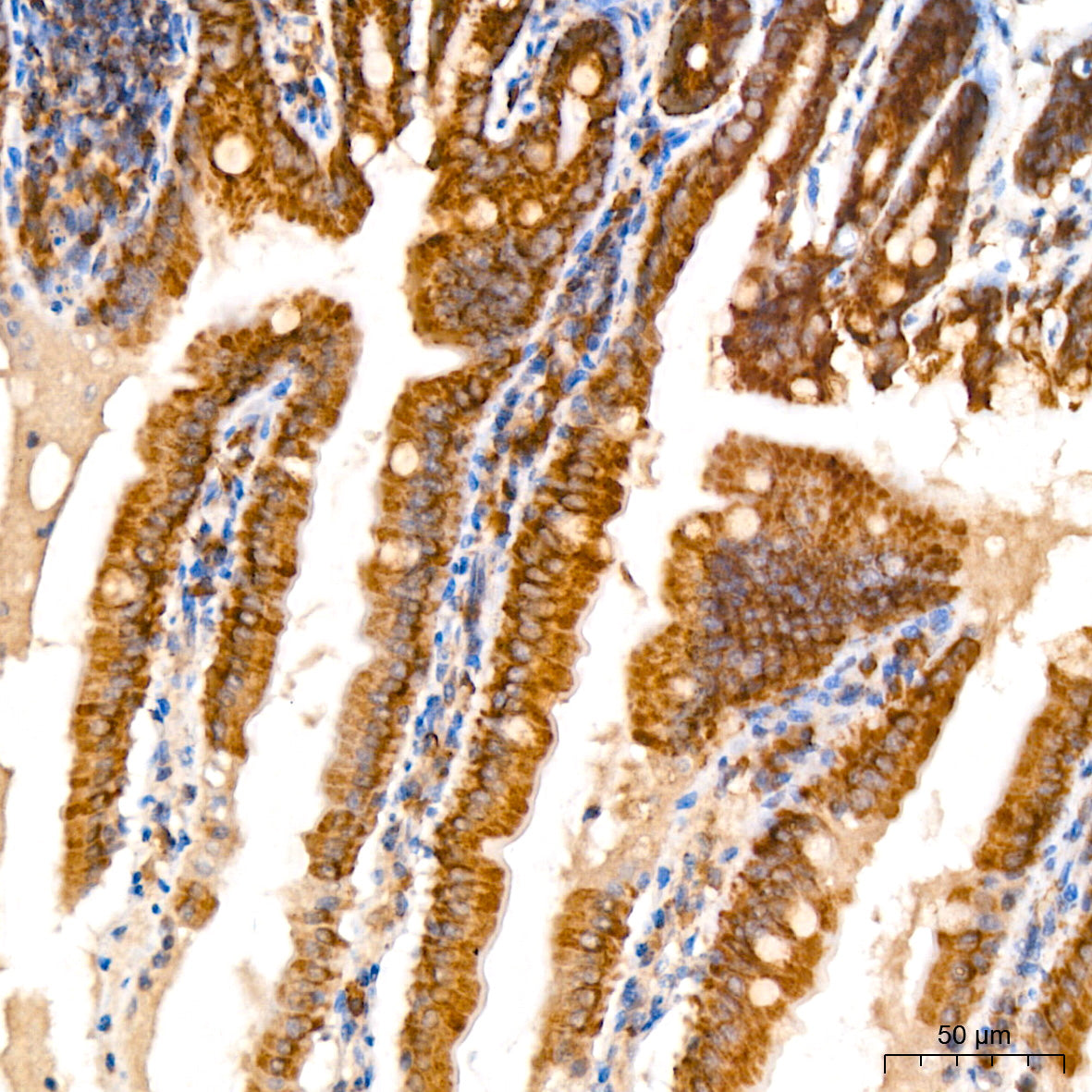 TOMM40 Rabbit mAb