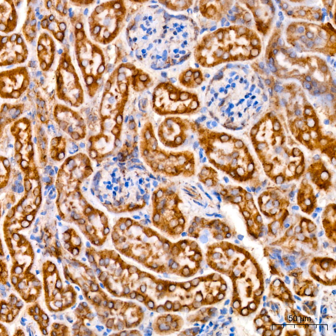 TOMM40 Rabbit mAb
