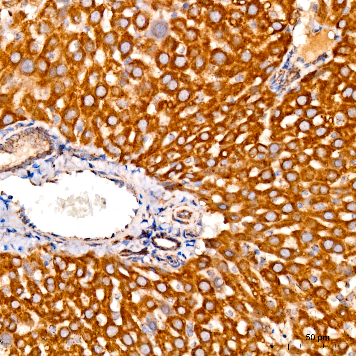 TOMM40 Rabbit mAb