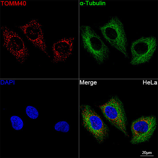 TOMM40 Rabbit mAb