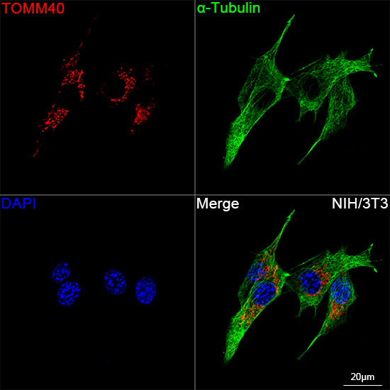 TOMM40 Rabbit mAb