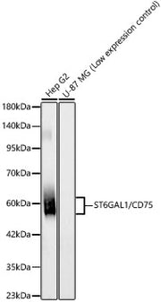 ST6GAL1/CD75 Rabbit mAb