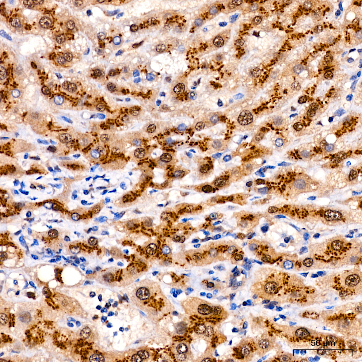 ST6GAL1/CD75 Rabbit mAb