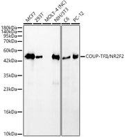 COUP-TFII/NR2F2 Rabbit mAb