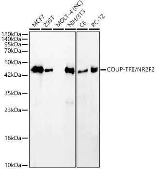 COUP-TFII/NR2F2 Rabbit mAb