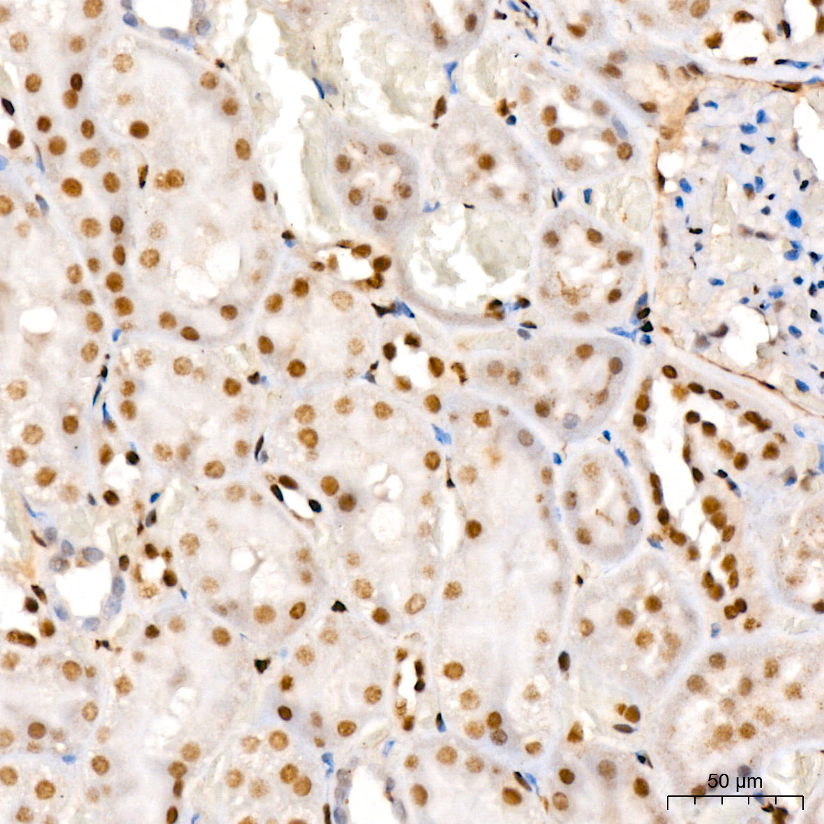 COUP-TFII/NR2F2 Rabbit mAb