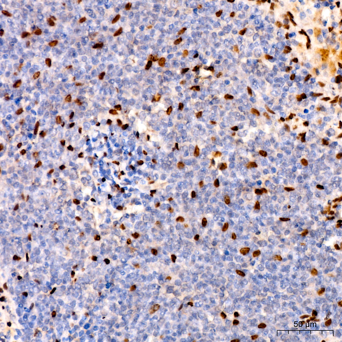 COUP-TFII/NR2F2 Rabbit mAb