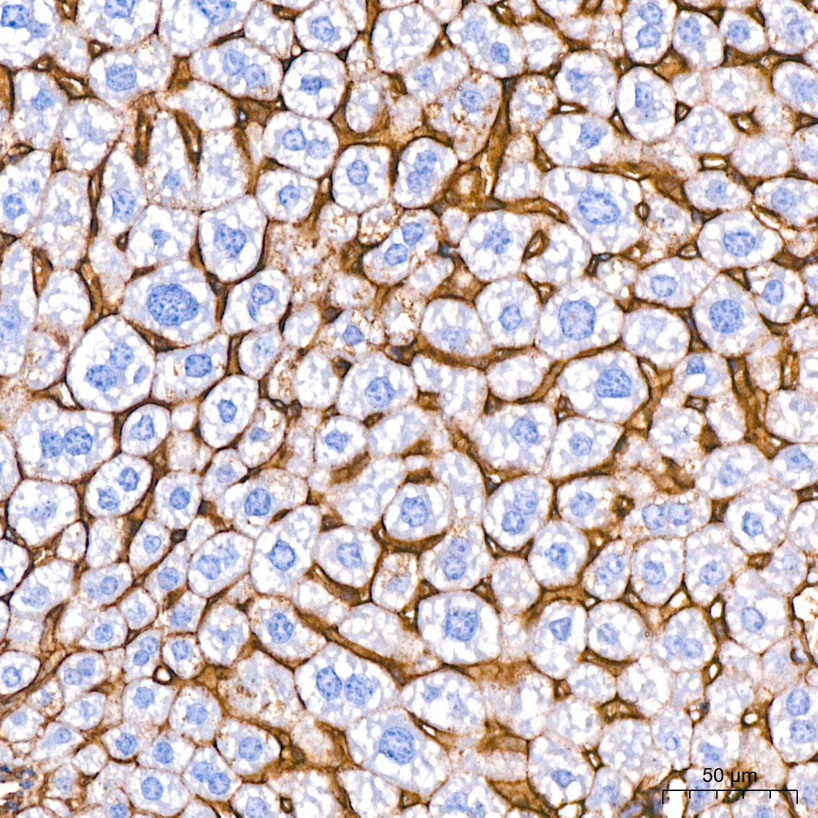 ICAM-1/CD54 Rabbit mAb