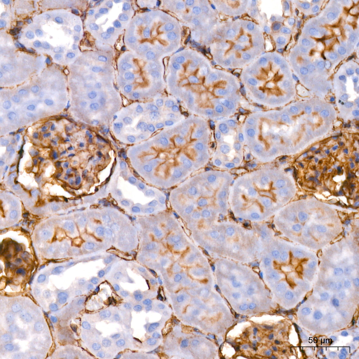 ICAM-1/CD54 Rabbit mAb