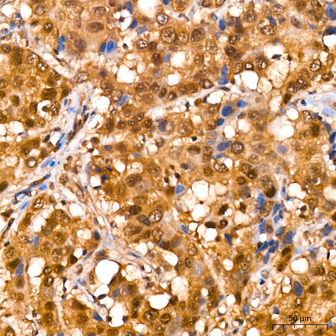 CRBN Rabbit mAb