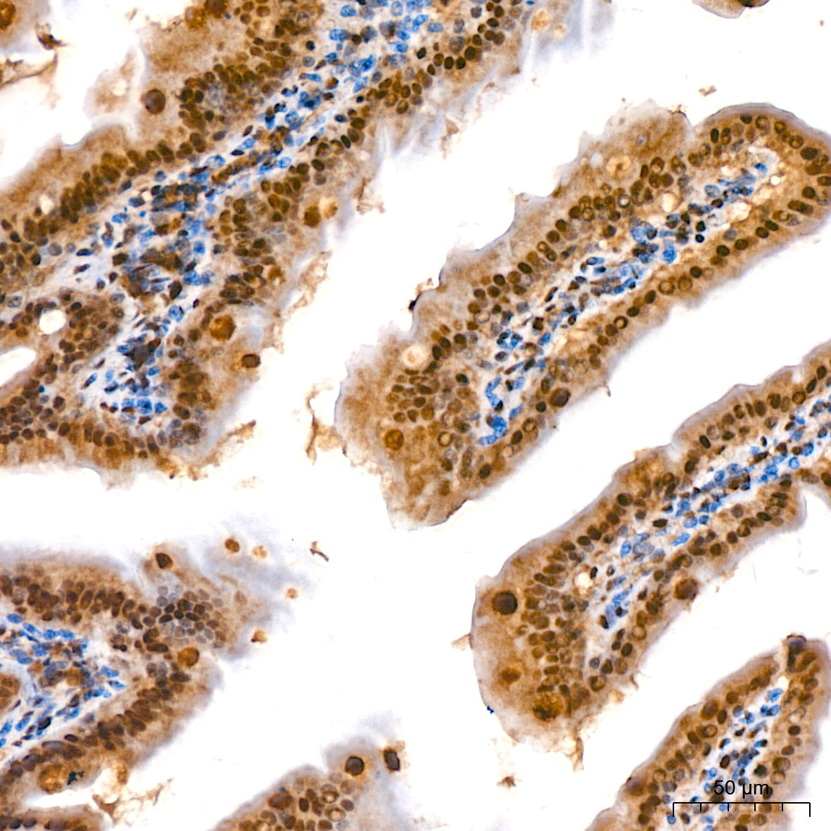 CRBN Rabbit mAb