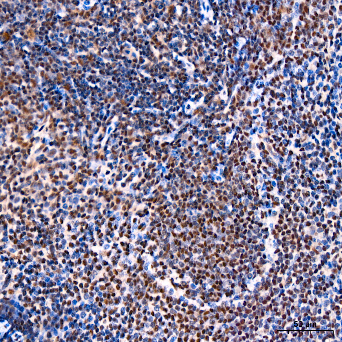 CRBN Rabbit mAb