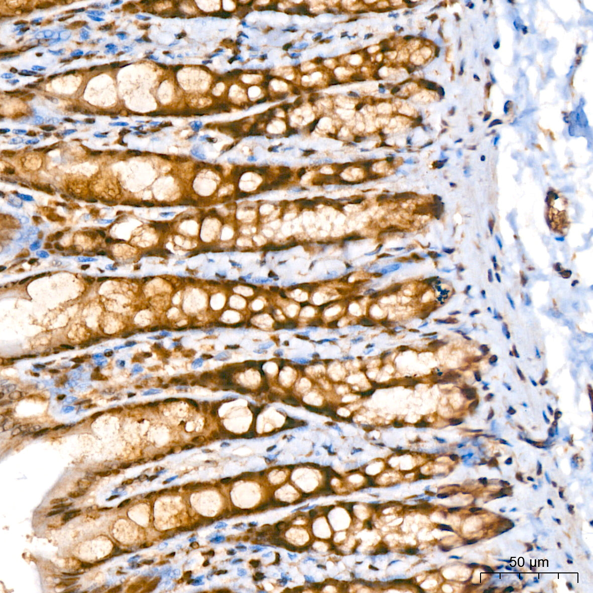 CRBN Rabbit mAb