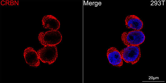 CRBN Rabbit mAb