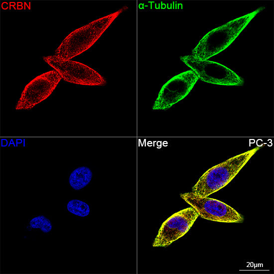 CRBN Rabbit mAb