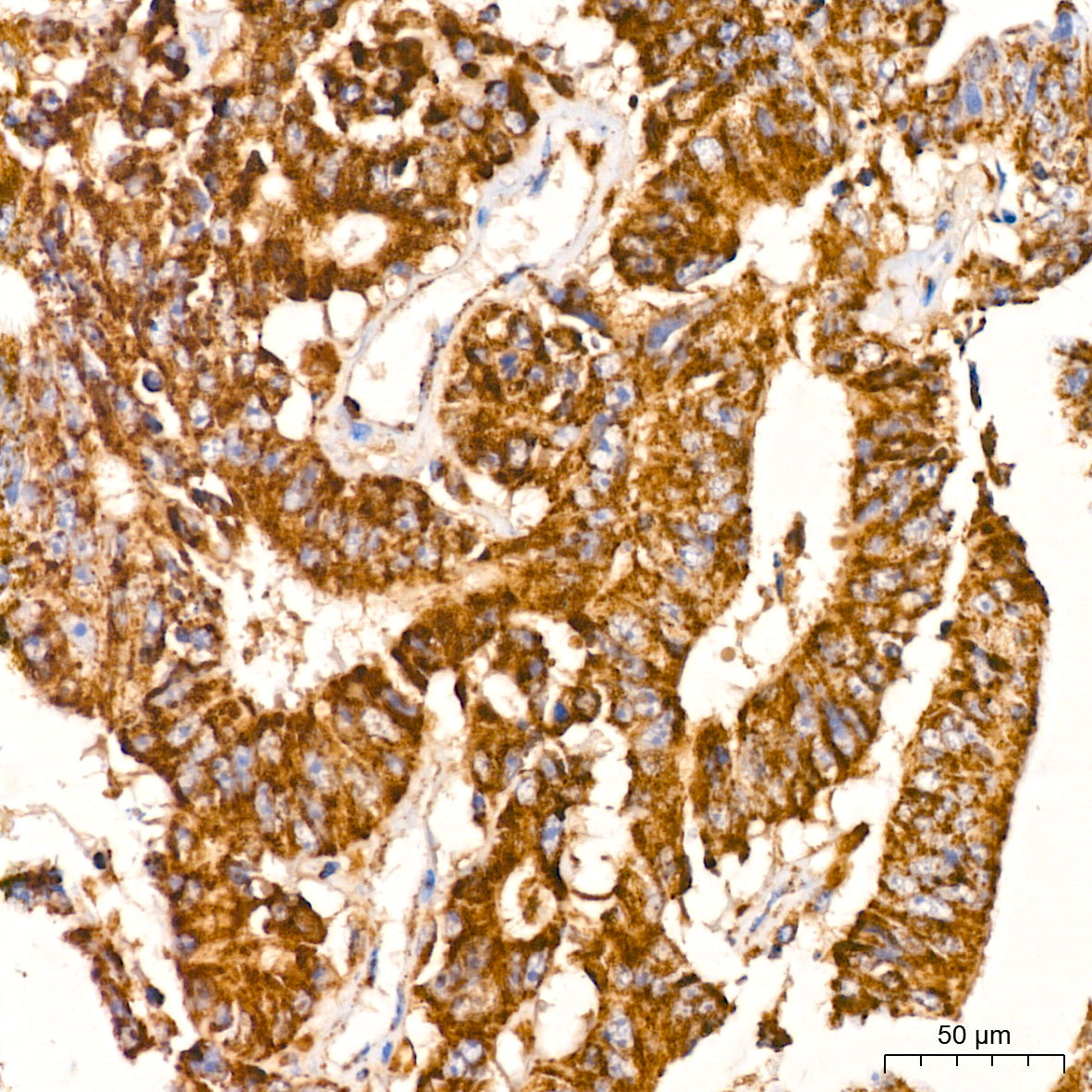 PITRM1 Rabbit mAb