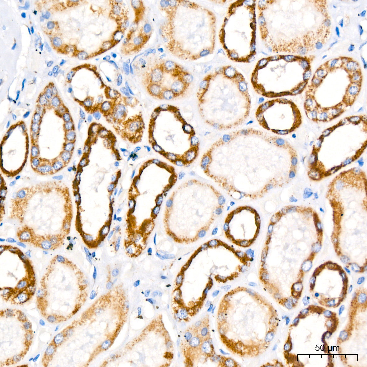 PITRM1 Rabbit mAb
